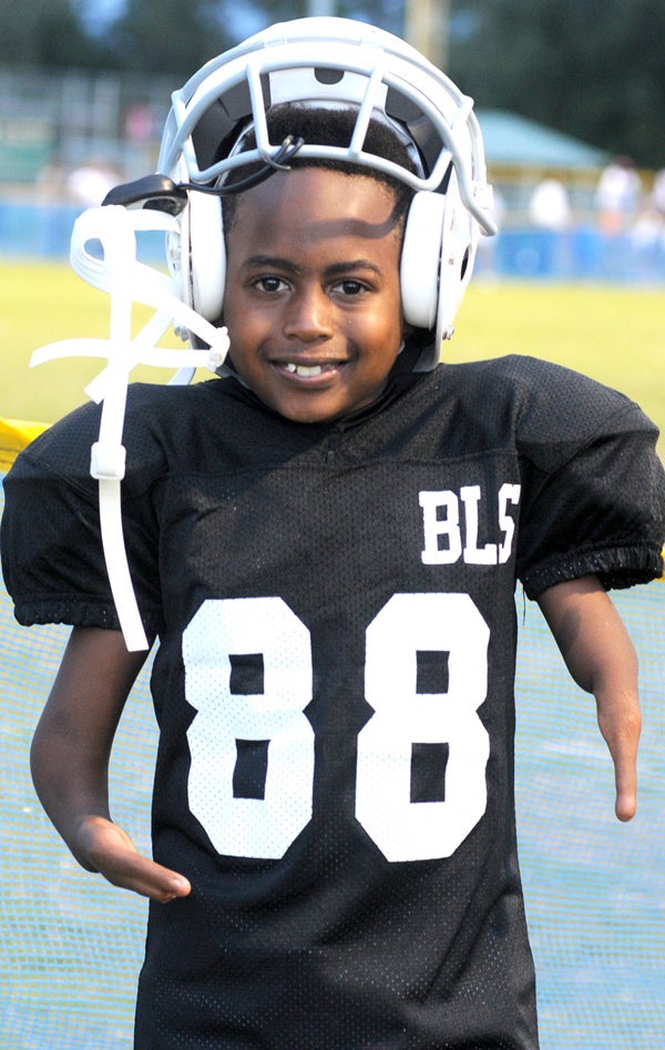 Eight-year-old Ja’Mauri doesn’t take a back seat to playing ball, despite looking a little different with features people ask him about all the time. He plays football, baseball and soccer and says he loves to tackle. 